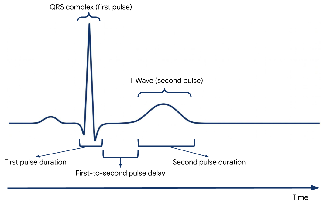 ECG 세그먼트와 특징적인 파형의 플롯